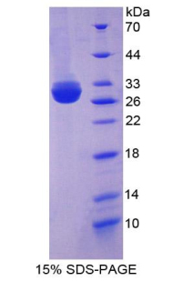 Recombinant Membrane Protein, Palmitoylated 5 (MPP5)