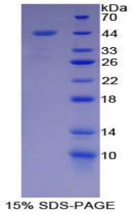 Recombinant Mucin 5 Subtype AC (MUC5AC)