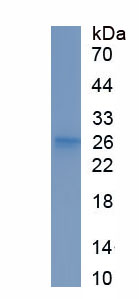 Recombinant Lipase, Hepatic (LIPC)