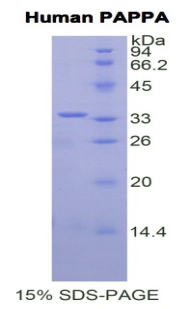 RPA800Hu02.jpg