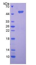 Recombinant Alkaline Sphingomyelinase (Alk-Smase)