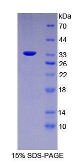 Recombinant Fucosidase Alpha L1, Tissue (FUCa1)