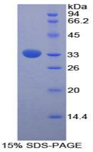 Recombinant Fucosidase Alpha L1, Tissue (FUCa1)