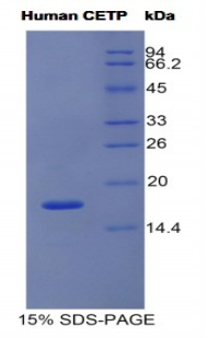 RPA814Hu02.jpg