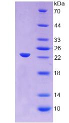 Recombinant Alpha-1-Acid Glycoprotein (a1AGP)