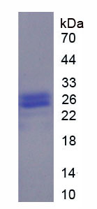 Recombinant Alpha-1-Acid Glycoprotein (a1AGP)