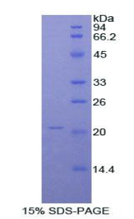 Recombinant Alpha-1-Acid Glycoprotein (a1AGP)