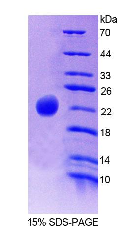 Recombinant Haptoglobin (Hpt)