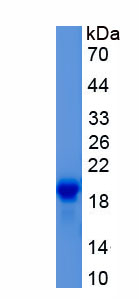 Recombinant Coagulation Factor II (F2)