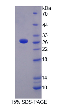 Recombinant C Reactive Protein (CRP)