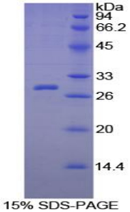 Recombinant C Reactive Protein (CRP)