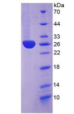 Recombinant C Reactive Protein (CRP)