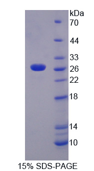 Recombinant Tumor Necrosis Factor Ligand Superfamily, Member 14 (TNFSF14)