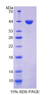 Recombinant Follicle Stimulating Hormone (FSH)