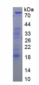 RPA831Hu01.jpg