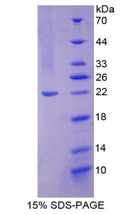 RPA837Hu01.jpg