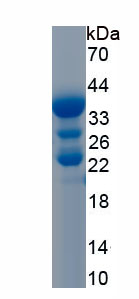 Recombinant Thyrotropin Releasing Hormone (TRH)