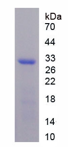 Recombinant Coagulation Factor IX (F9)