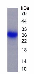 Recombinant Prolactin (PRL)