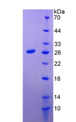 Recombinant Prolactin (PRL)