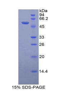 Recombinant Prolactin (PRL)