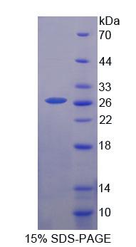 Recombinant Prolactin (PRL)