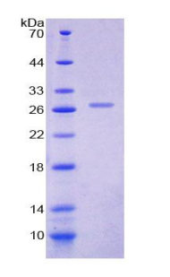 Recombinant Prolactin (PRL)