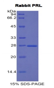 Recombinant Prolactin (PRL)