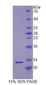 Recombinant Resistin (RETN)