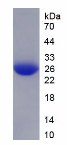 Recombinant Glycogen Phosphorylase, Muscle (PYGM)