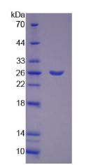 Recombinant Glycogen Phosphorylase, Muscle (PYGM)