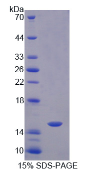 RPA853Hu02.jpg