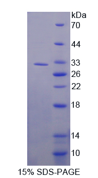 Recombinant Aminopeptidase A (ENPEP)