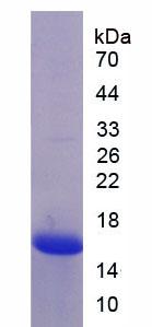 RPA859Hu01.jpg