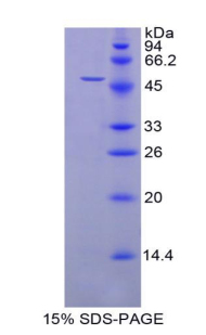 RPA867Hu01.jpg