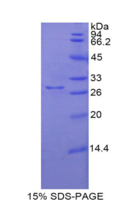 Recombinant Endothelial NOS (eNOS)