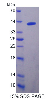 Recombinant Heat Shock Protein 40 (HSP40)