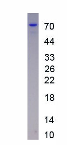 Recombinant Insulin Receptor (INSR)