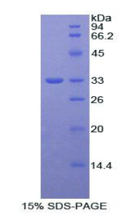 Recombinant Insulin Receptor (INSR)