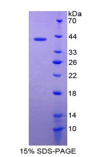 Recombinant Cystatin C (Cys-C)