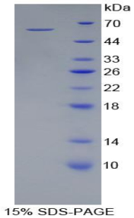 RPA902Hu01.jpg