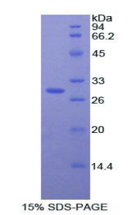 Recombinant Acid Phosphatase 5, Tartrate Resistant (ACP5)