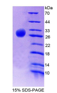 RPA905Hu01.jpg