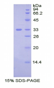 RPA909Hu01.jpg