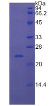 Recombinant Retinol Binding Protein 4 (RBP4)