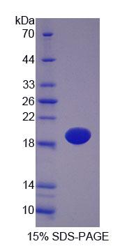 Recombinant Podocin (PDCN)