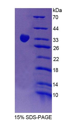 Recombinant Signal Regulatory Protein Gamma (SIRPg)