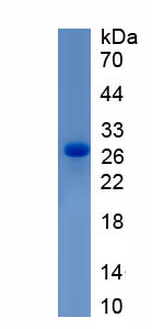 Recombinant Cluster Of Differentiation 6 (CD6)