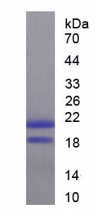 RPA954Hu02.jpg