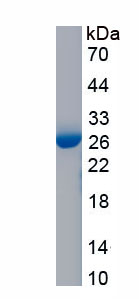 Recombinant Procollagen I N-Terminal Propeptide (PINP)